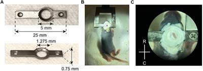 An in vivo Calcium Imaging Approach for the Identification of Cell-Type Specific Patterns in the Developing Cortex